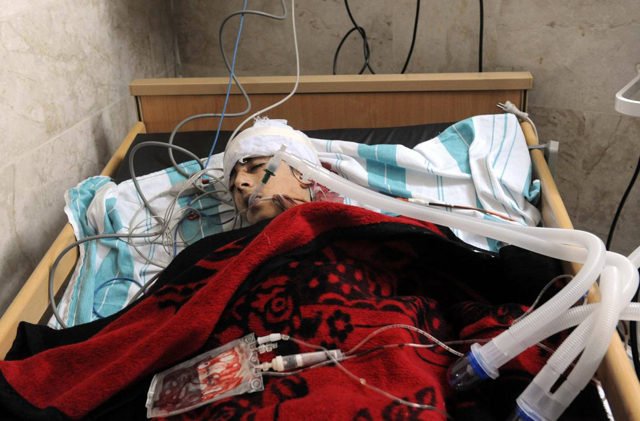 Тяжело раненный человек лежит на постеле. г. Идлиб, 24 февраля 2012 года. Bulent Kilic / AFP / Getty